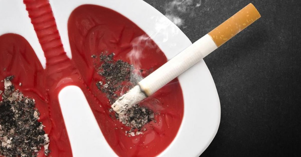 Avanza el proyecto que prohíbe arrojar cigarrillos en espacios públicos