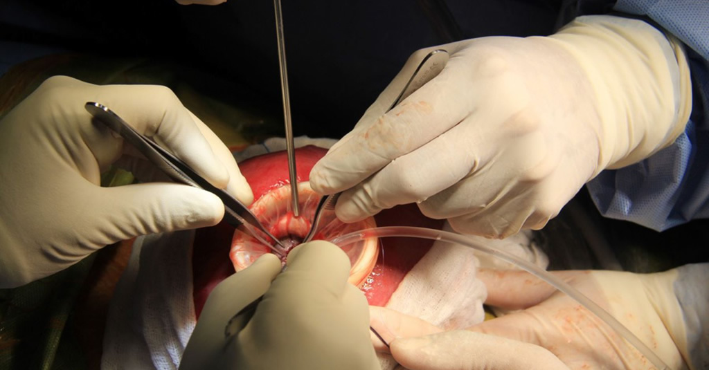 El Fondo Nacional de Recursos ahora financia las cirugías fetales